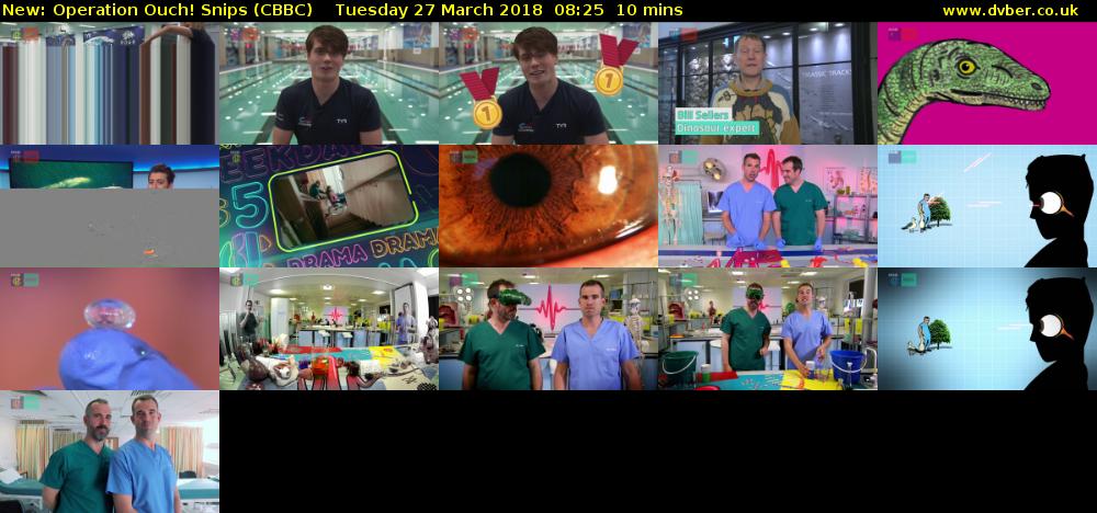 Operation Ouch! Snips (CBBC) Tuesday 27 March 2018 08:25 - 08:35