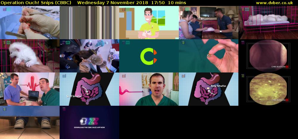 Operation Ouch! Snips (CBBC) Wednesday 7 November 2018 17:50 - 18:00