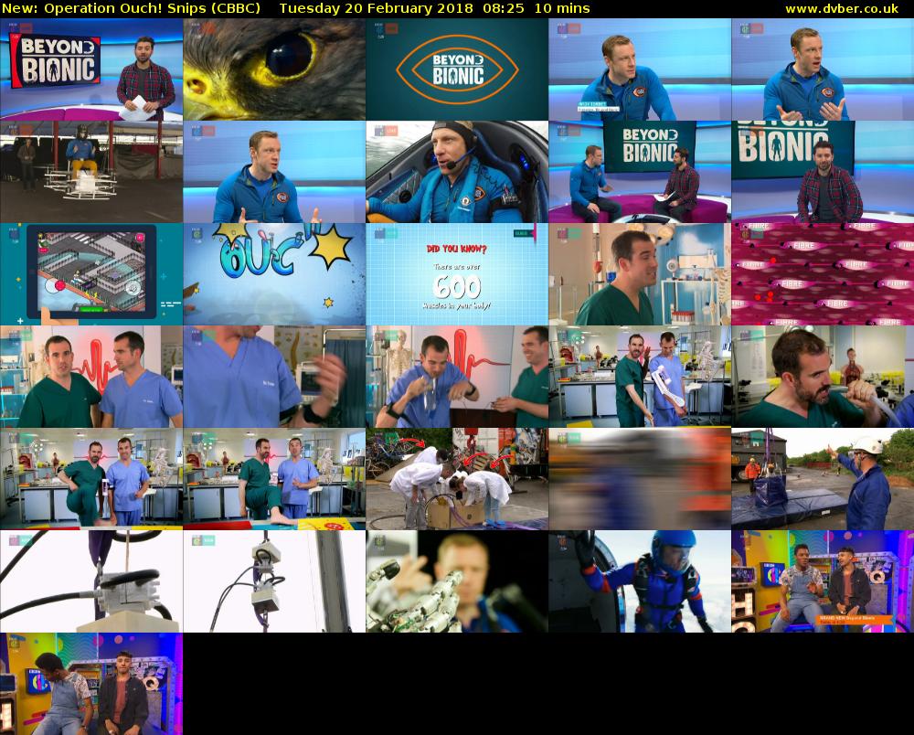 Operation Ouch! Snips (CBBC) Tuesday 20 February 2018 08:25 - 08:35