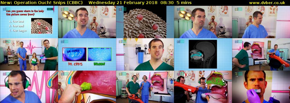 Operation Ouch! Snips (CBBC) Wednesday 21 February 2018 08:30 - 08:35