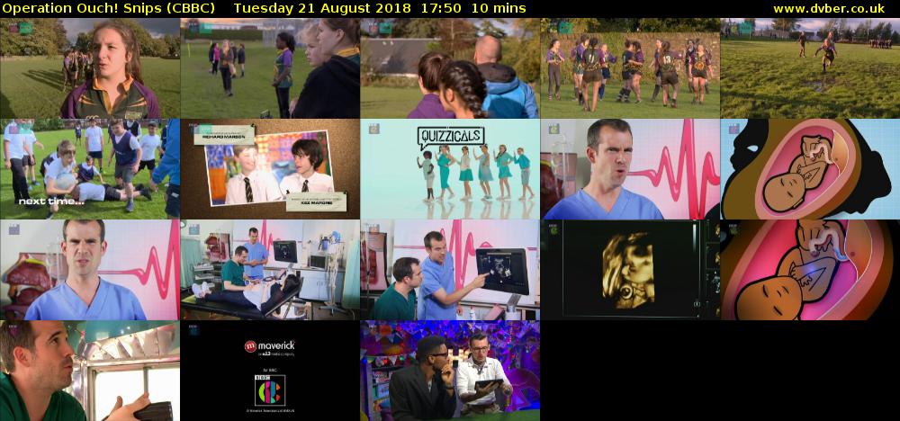 Operation Ouch! Snips (CBBC) Tuesday 21 August 2018 17:50 - 18:00