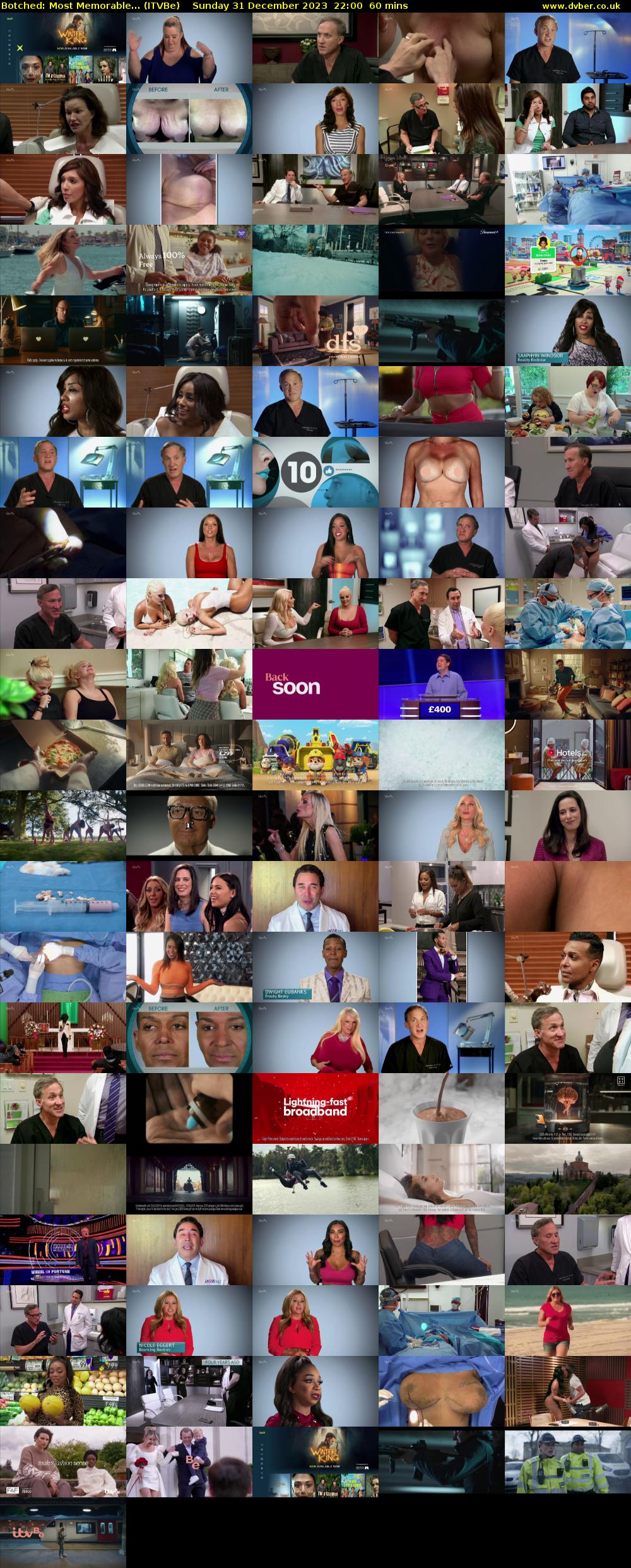 Botched: Most Memorable... (ITVBe) Sunday 31 December 2023 22:00 - 23:00
