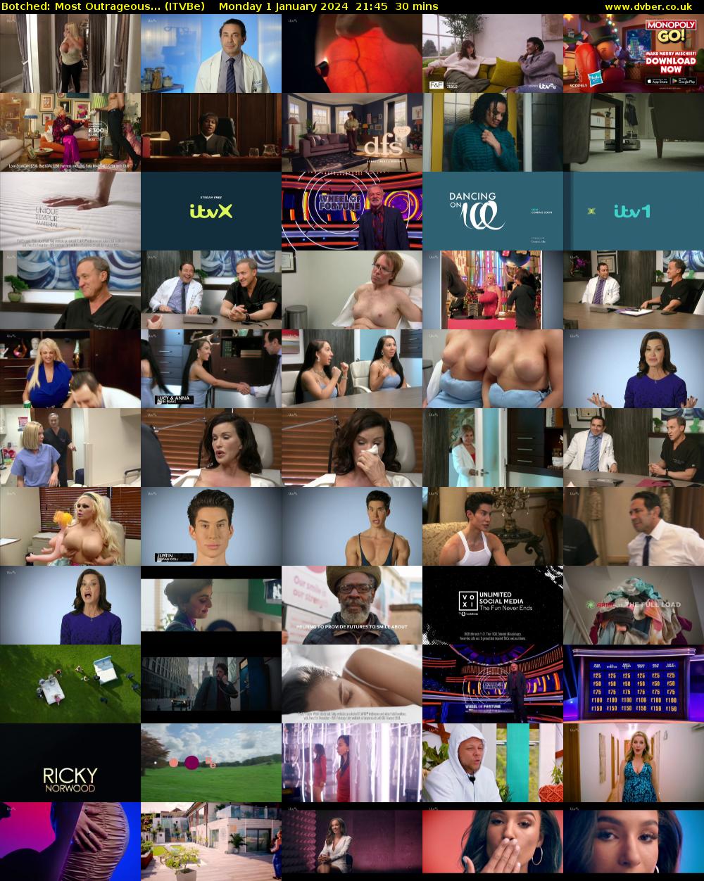 Botched: Most Outrageous... (ITVBe) Monday 1 January 2024 21:45 - 22:15