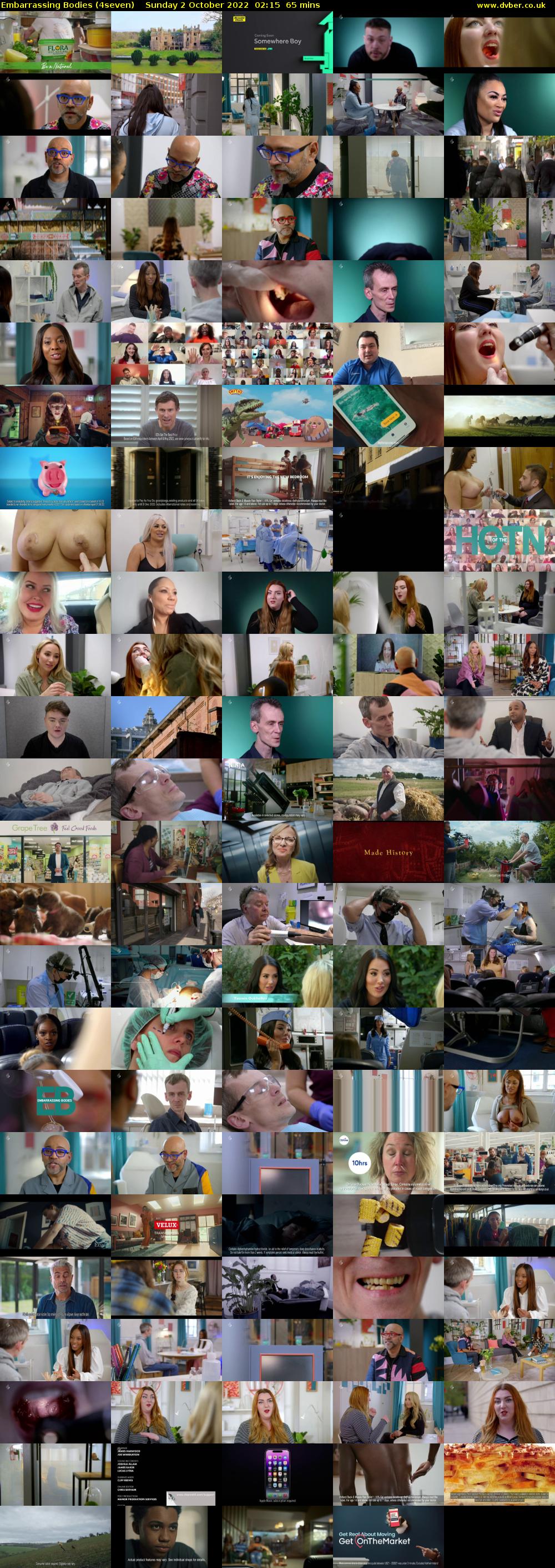 Embarrassing Bodies (4seven) Sunday 2 October 2022 02:15 - 03:20