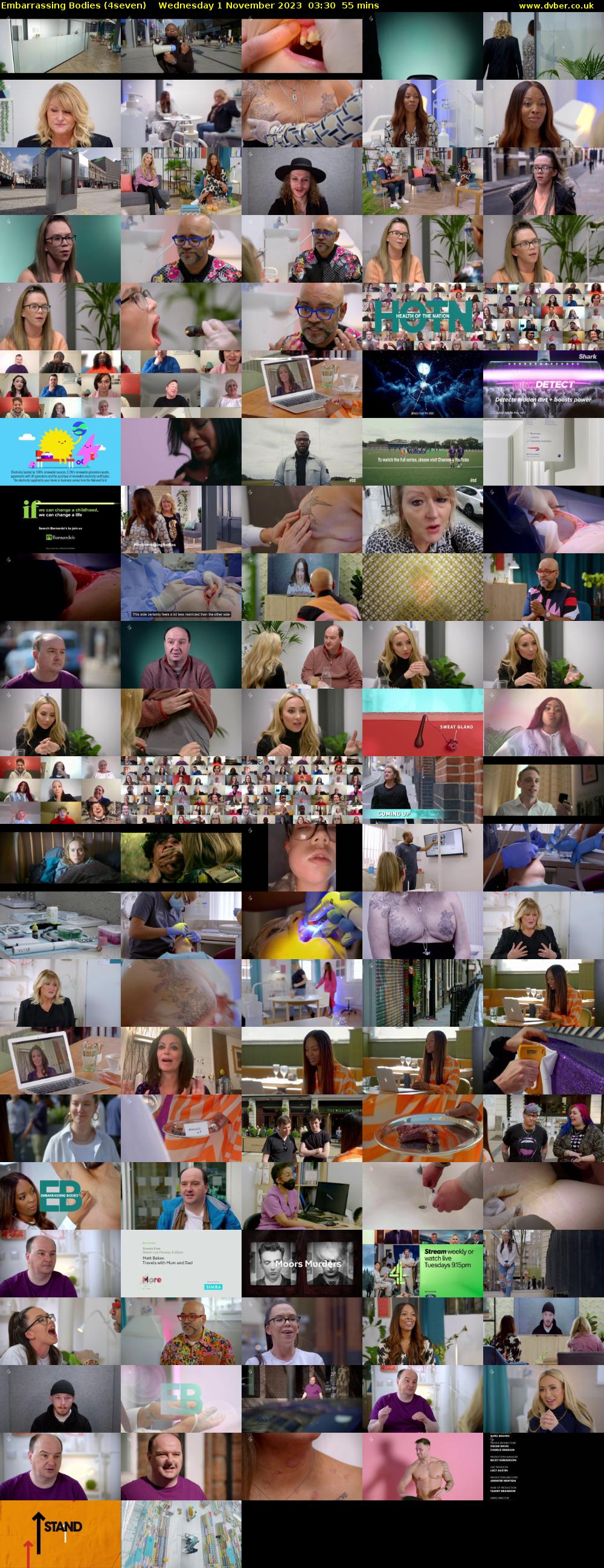 Embarrassing Bodies (4seven) Wednesday 1 November 2023 03:30 - 04:25