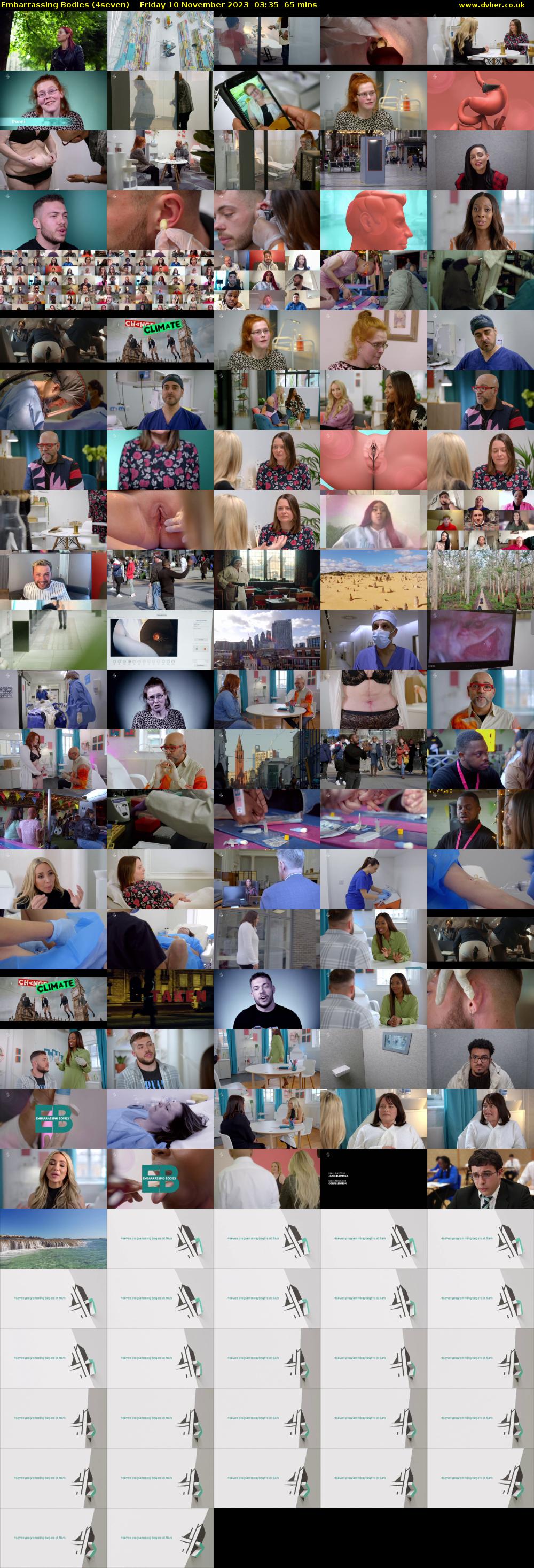 Embarrassing Bodies (4seven) Friday 10 November 2023 03:35 - 04:40