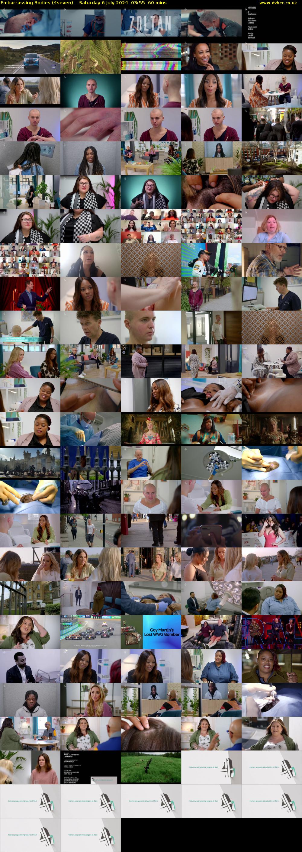 Embarrassing Bodies (4seven) Saturday 6 July 2024 03:55 - 04:55