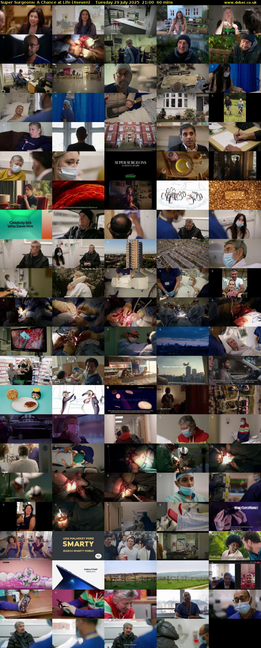 Super Surgeons: A Chance at Life (4seven) Tuesday 29 July 2025 21:00 - 22:00