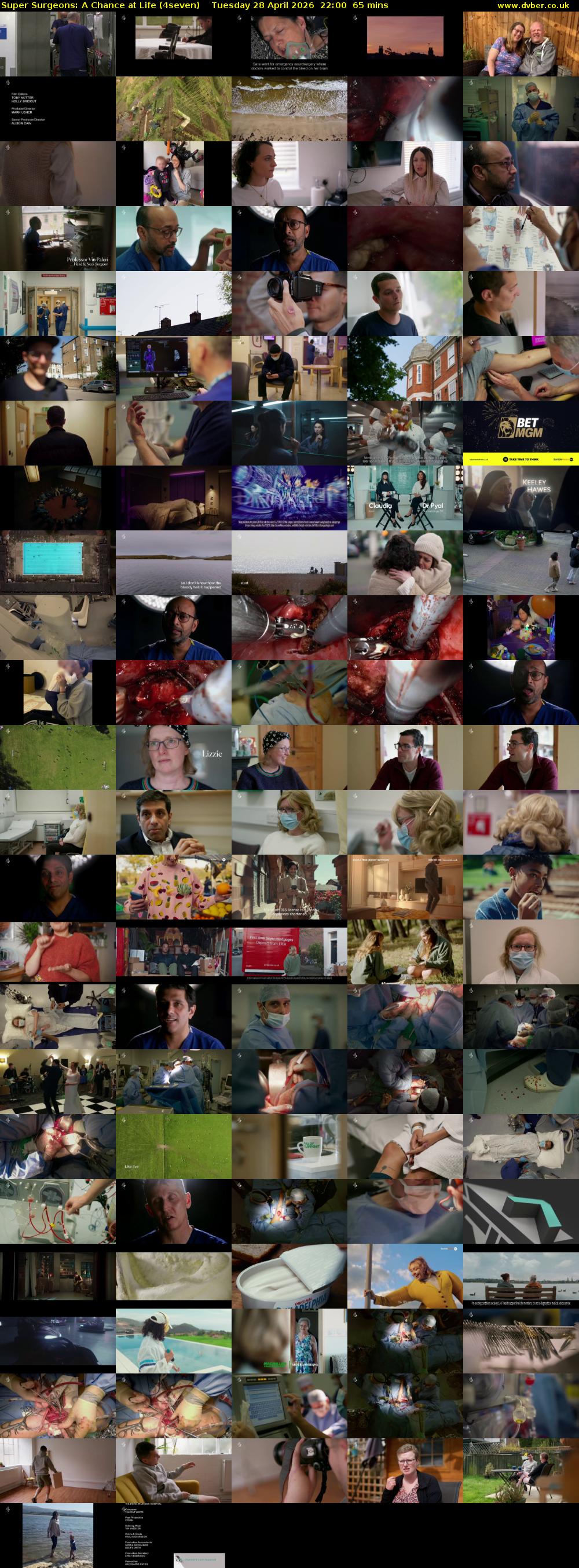 Super Surgeons: A Chance at Life (4seven) Tuesday 28 April 2026 22:00 - 23:05
