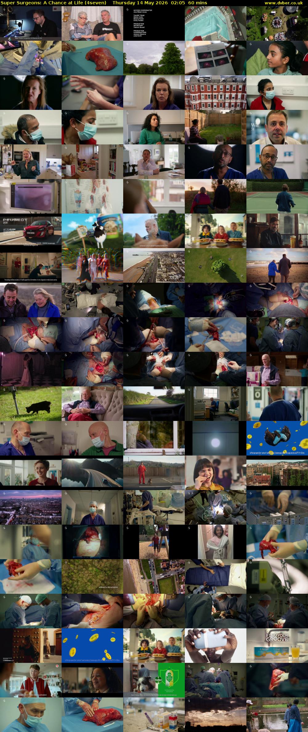 Super Surgeons: A Chance at Life (4seven) Thursday 14 May 2026 02:05 - 03:05