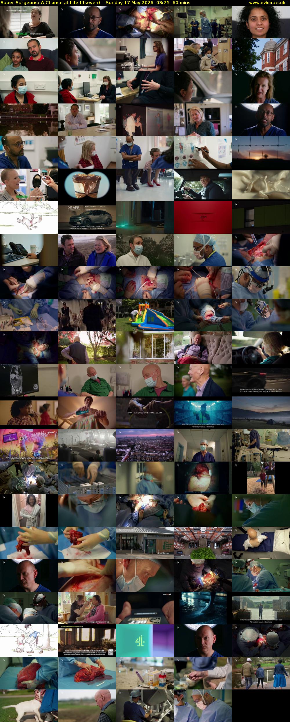 Super Surgeons: A Chance at Life (4seven) Sunday 17 May 2026 03:25 - 04:25
