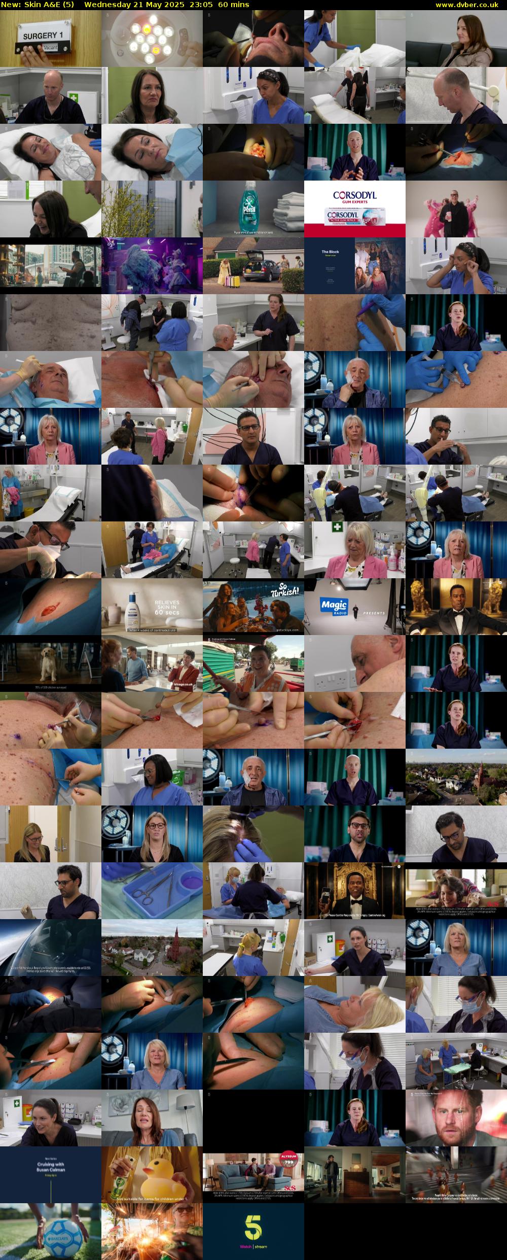 Skin A&E (5) Wednesday 21 May 2025 23:05 - 00:05