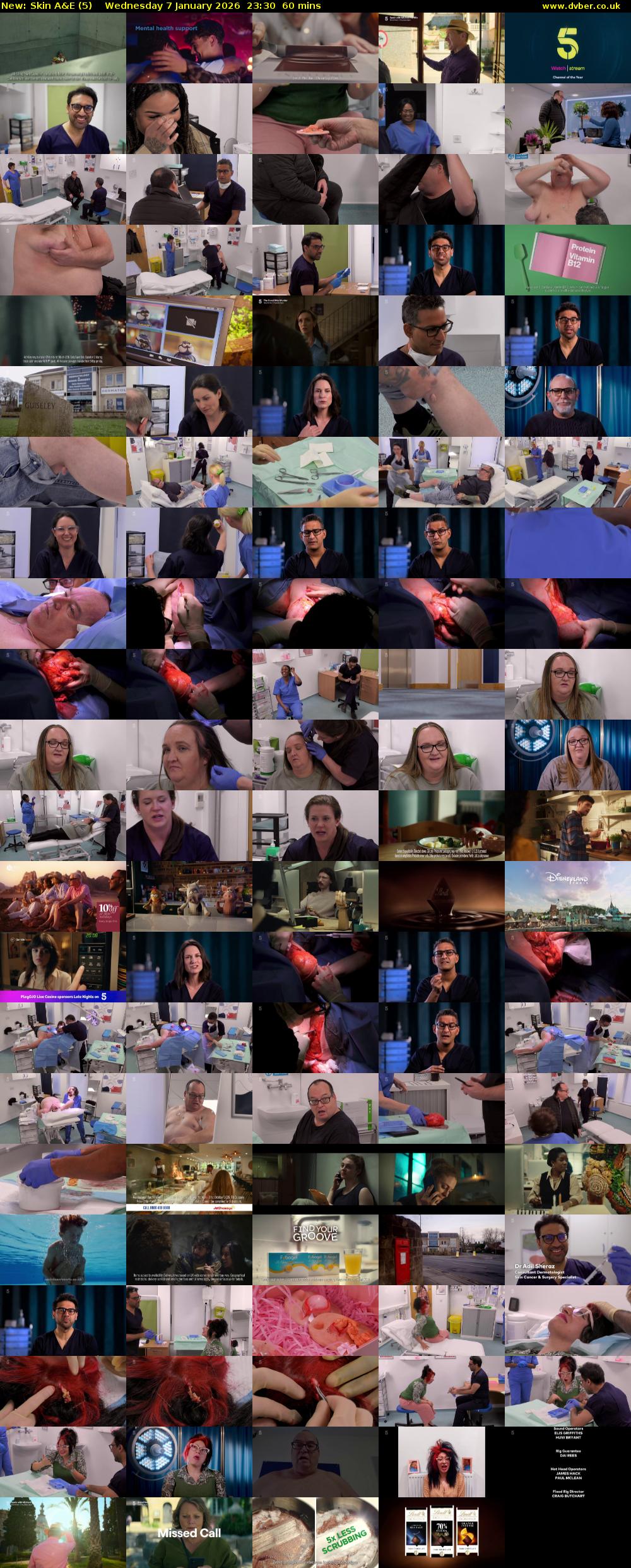 Skin A&E (5) Wednesday 7 January 2026 23:30 - 00:30