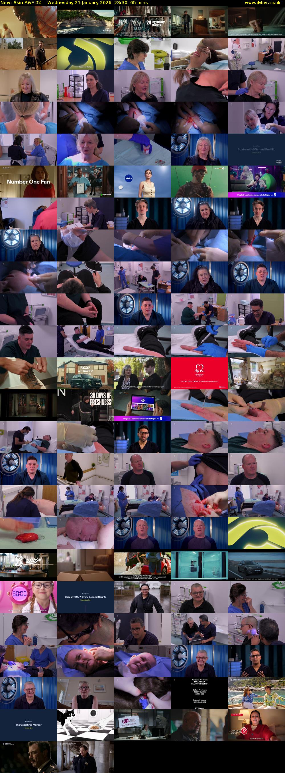 Skin A&E (5) Wednesday 21 January 2026 23:30 - 00:35