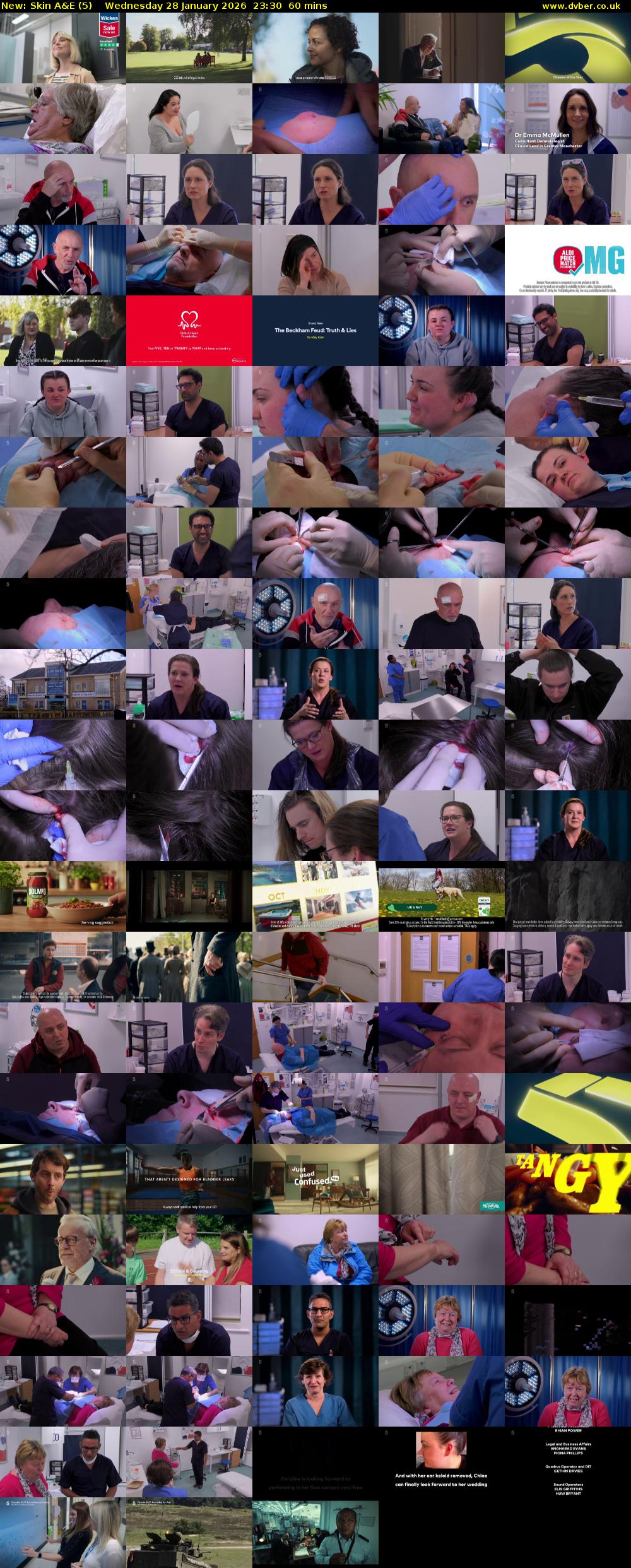Skin A&E (5) Wednesday 28 January 2026 23:30 - 00:30