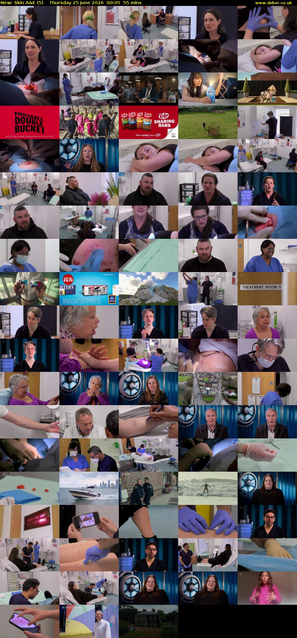 Skin A&E (5) Thursday 25 June 2026 00:05 - 01:00