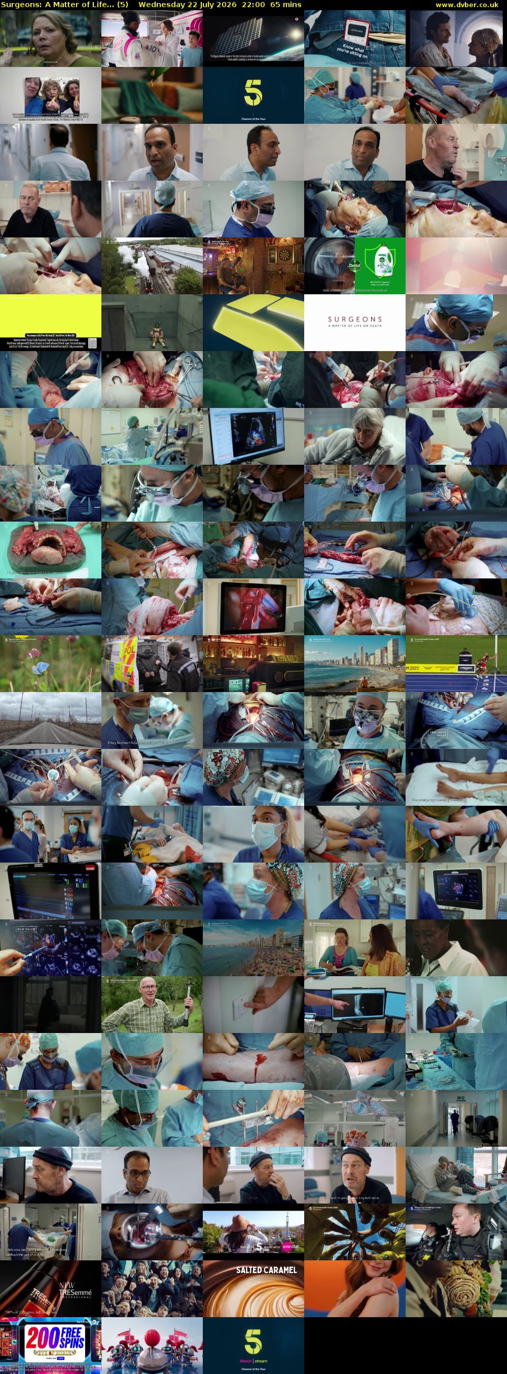 Surgeons: A Matter of Life... (5) Wednesday 22 July 2026 22:00 - 23:05