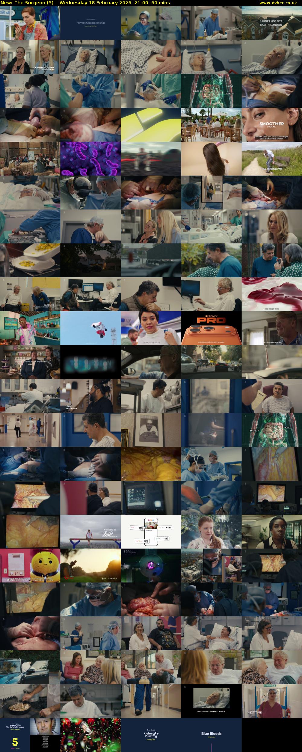 The Surgeon (5) Wednesday 18 February 2026 21:00 - 22:00