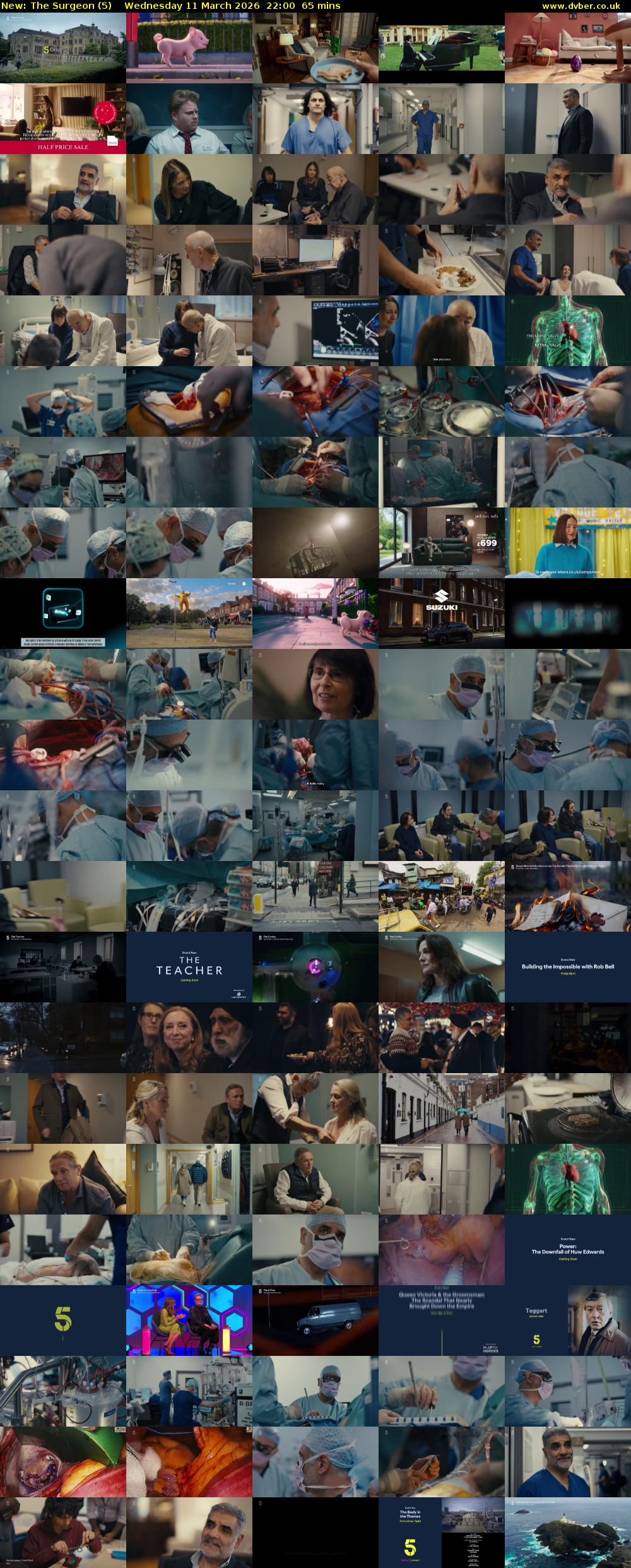 The Surgeon (5) Wednesday 11 March 2026 22:00 - 23:05
