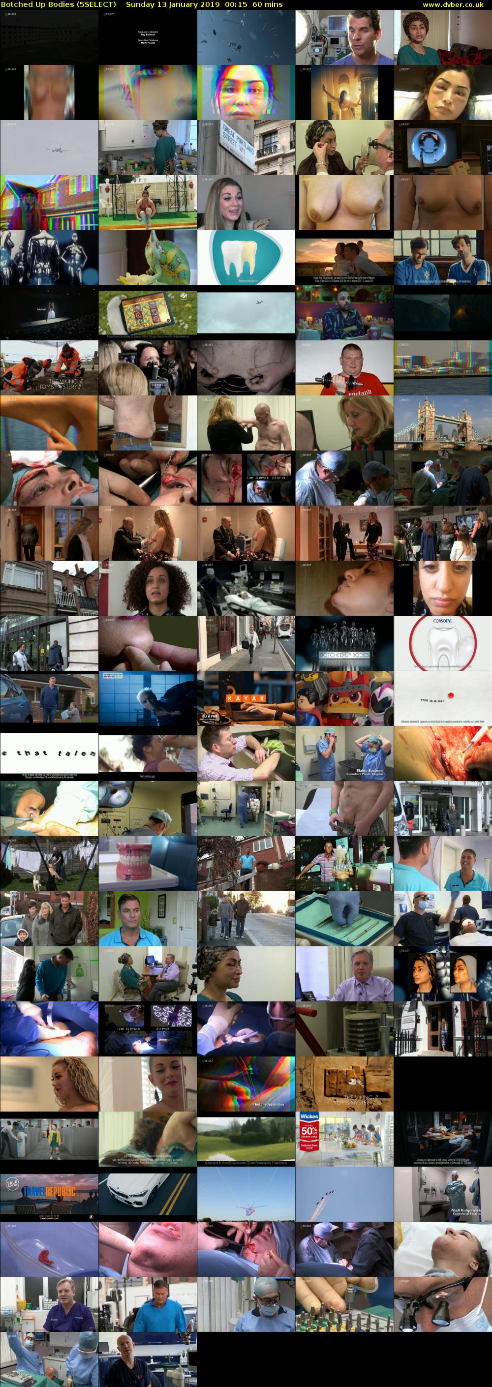 Botched Up Bodies (5SELECT) Sunday 13 January 2019 00:15 - 01:15