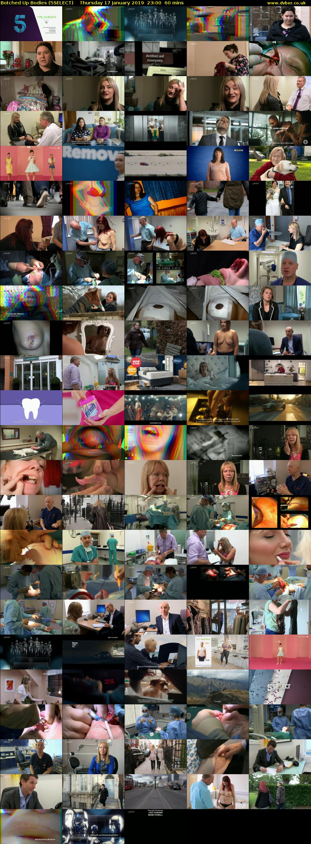 Botched Up Bodies (5SELECT) Thursday 17 January 2019 23:00 - 00:00