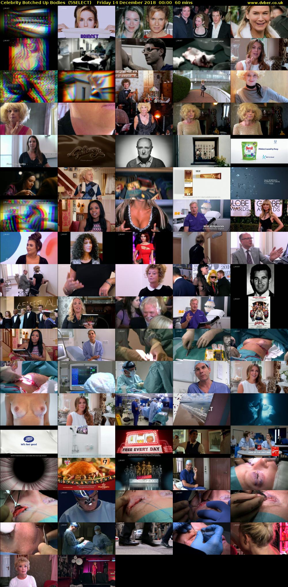 Celebrity Botched Up Bodies  (5SELECT) Friday 14 December 2018 00:00 - 01:00