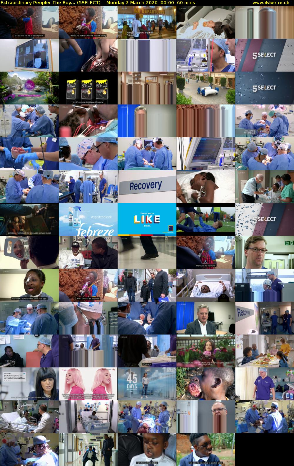 Extraordinary People: The Boy... (5SELECT) Monday 2 March 2020 00:00 - 01:00