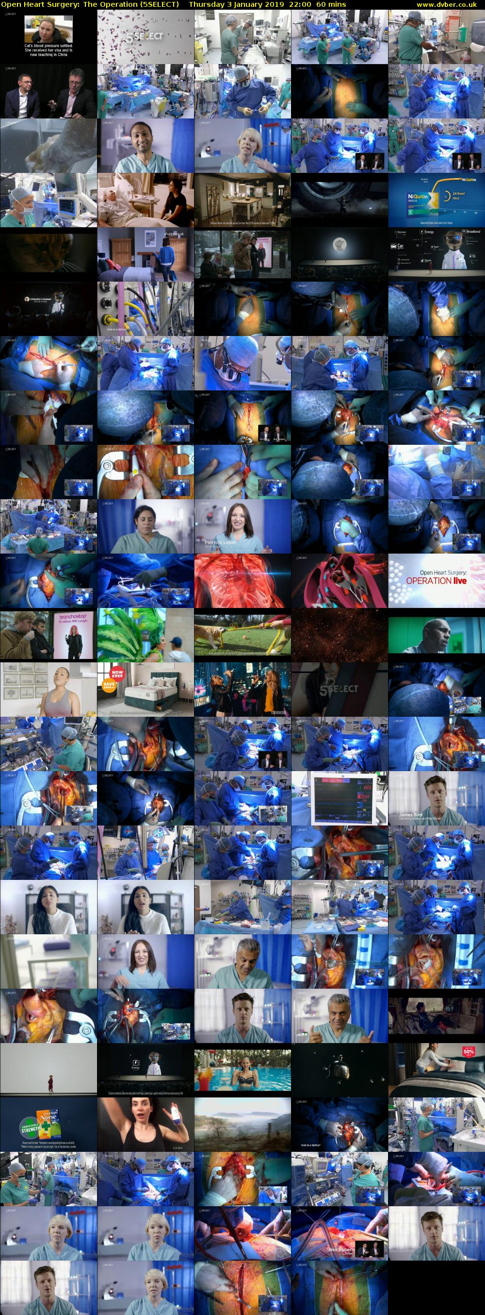 Open Heart Surgery: The Operation (5SELECT) Thursday 3 January 2019 22:00 - 23:00
