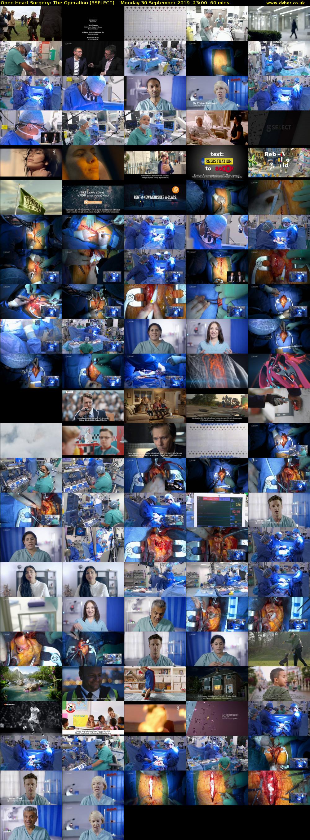 Open Heart Surgery: The Operation (5SELECT) Monday 30 September 2019 23:00 - 00:00