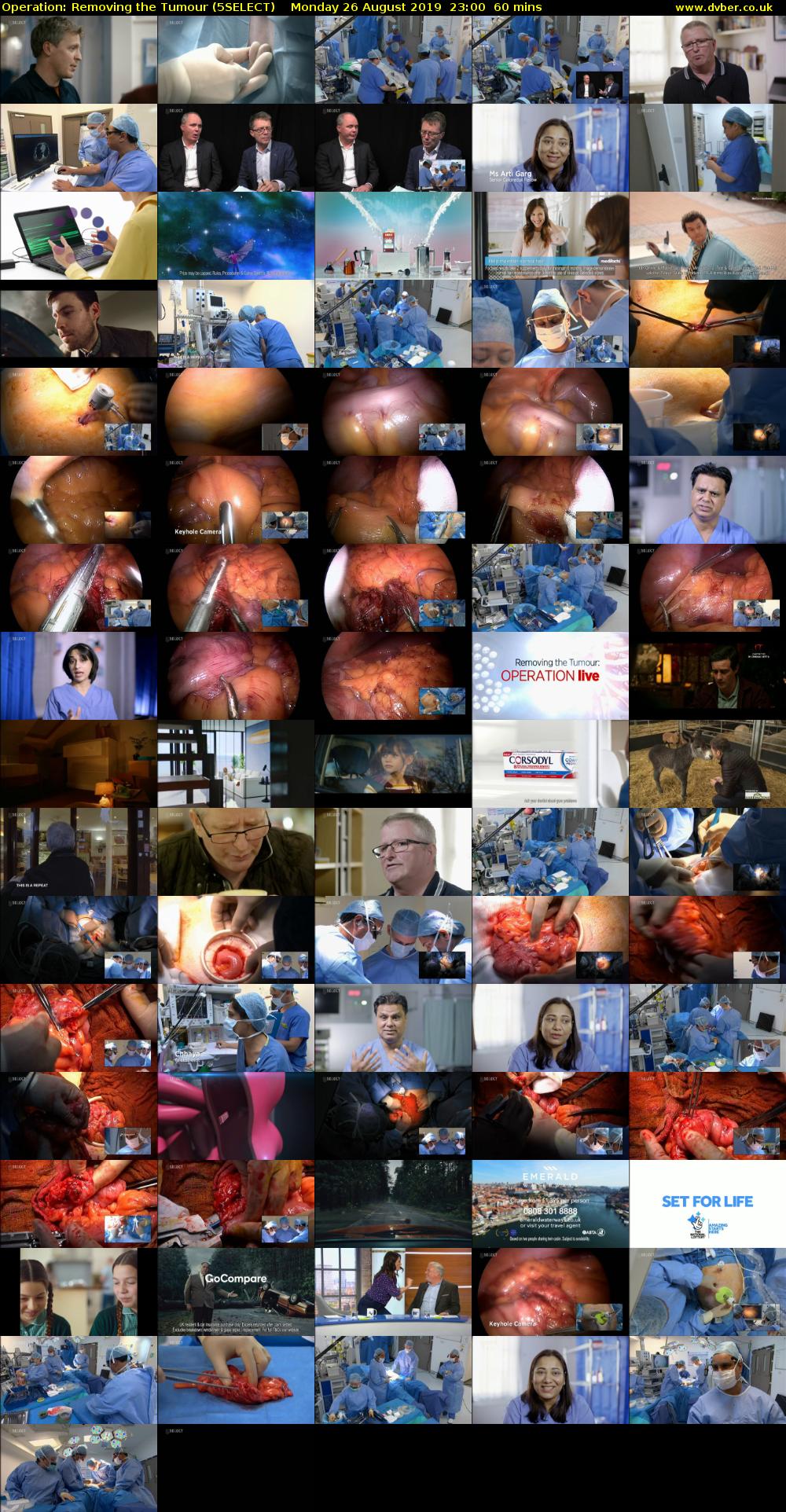 Operation: Removing the Tumour (5SELECT) Monday 26 August 2019 23:00 - 00:00