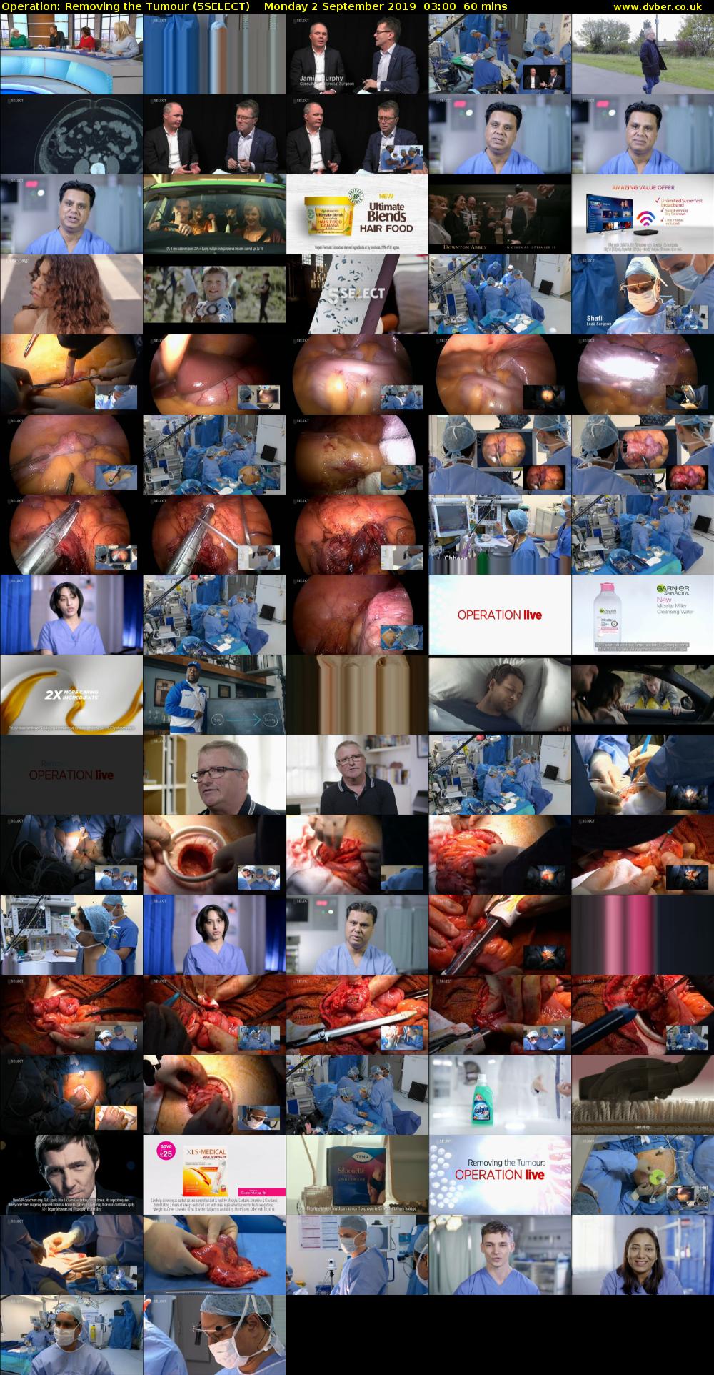 Operation: Removing the Tumour (5SELECT) Monday 2 September 2019 03:00 - 04:00