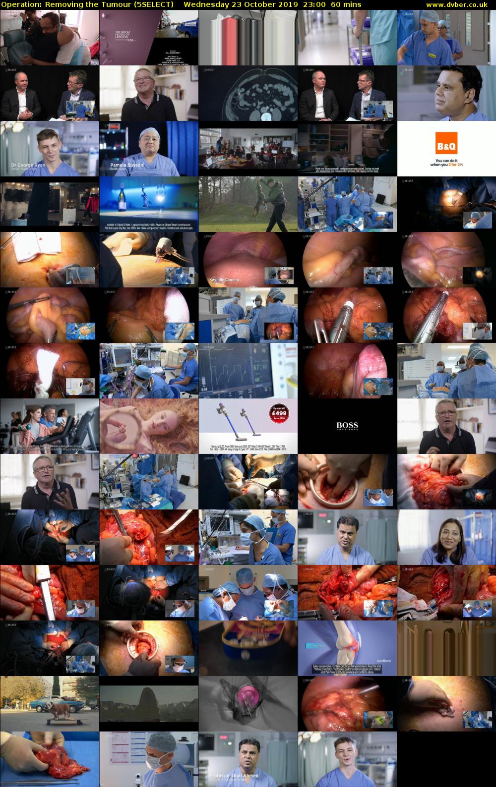 Operation: Removing the Tumour (5SELECT) Wednesday 23 October 2019 23:00 - 00:00
