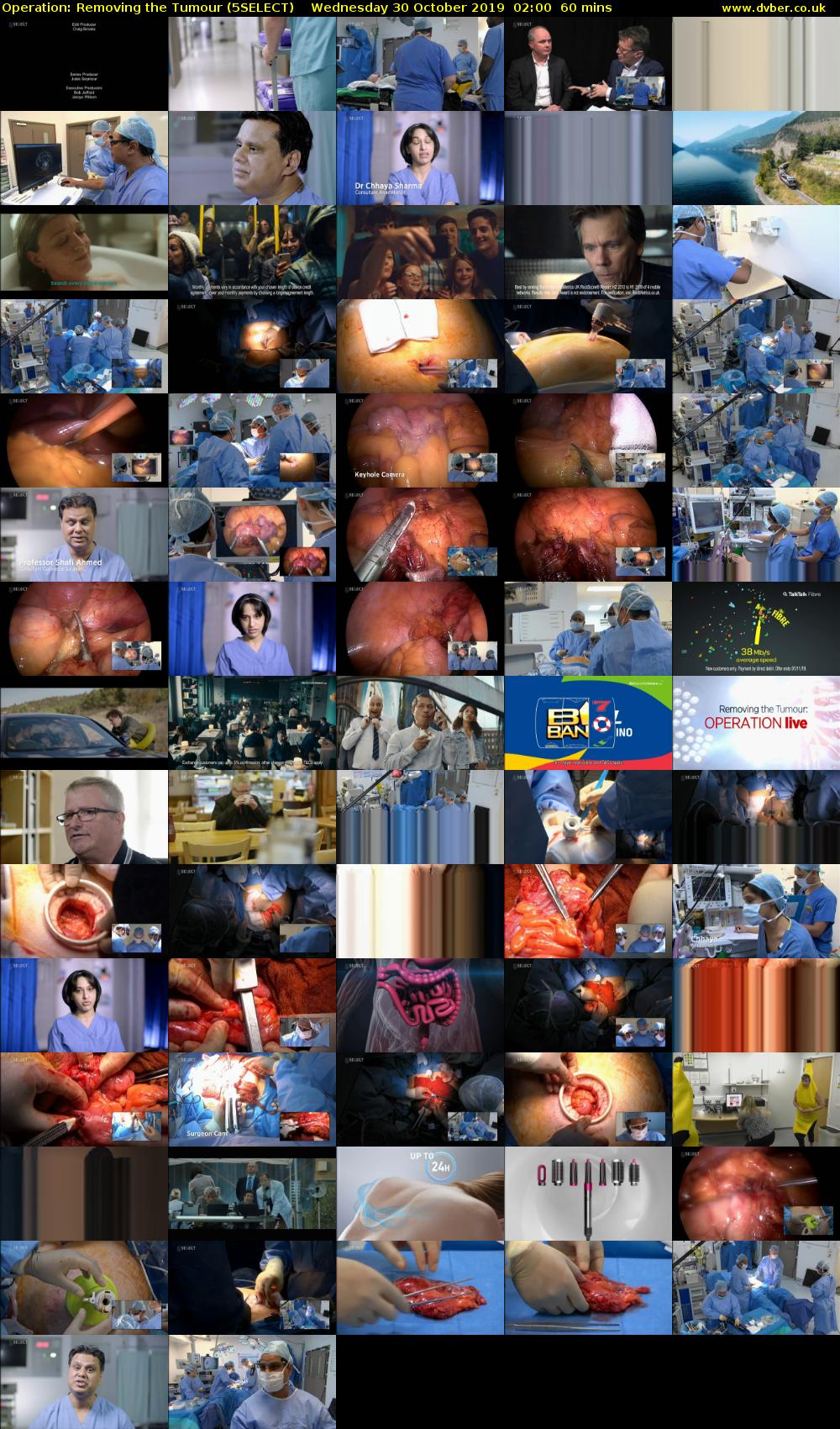 Operation: Removing the Tumour (5SELECT) Wednesday 30 October 2019 02:00 - 03:00