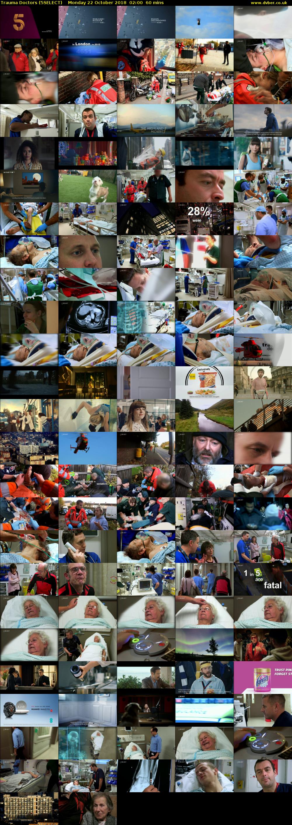 Trauma Doctors (5SELECT) Monday 22 October 2018 02:00 - 03:00