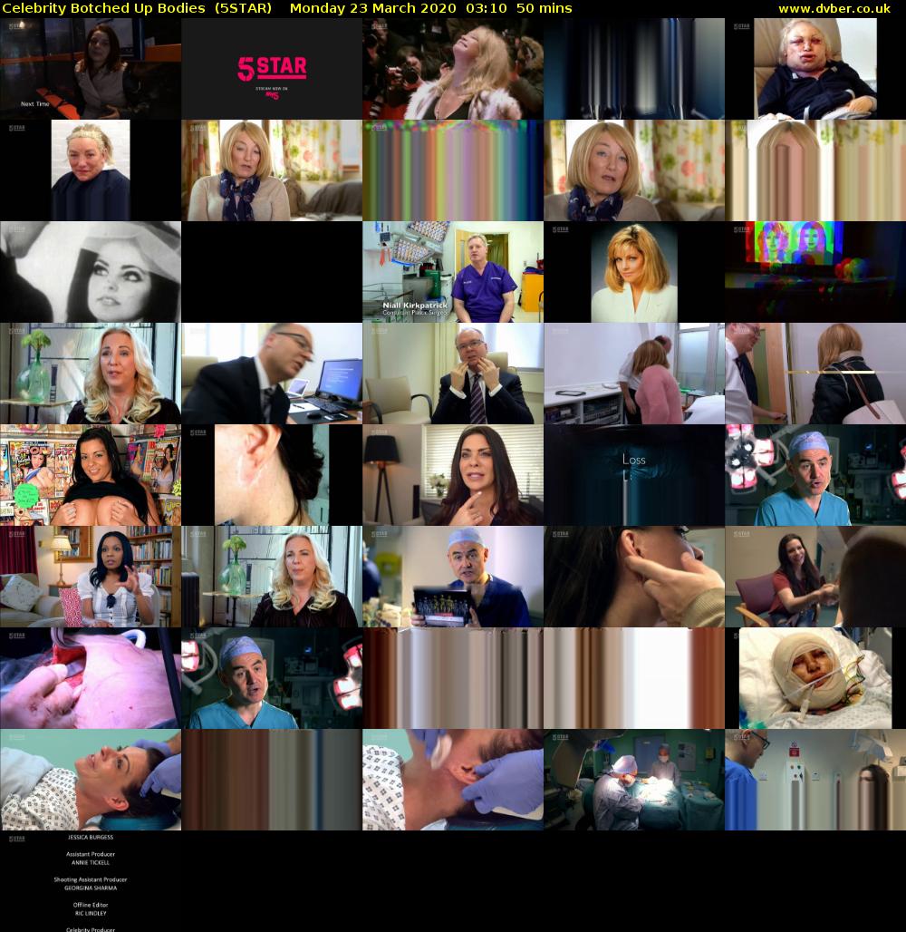 Celebrity Botched Up Bodies  (5STAR) Monday 23 March 2020 03:10 - 04:00