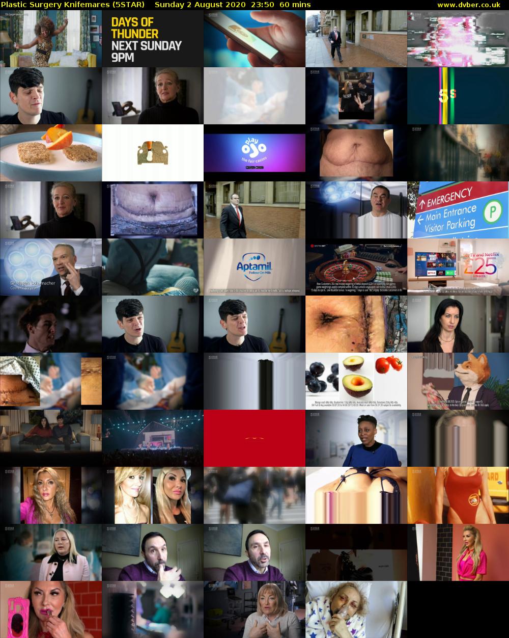 Plastic Surgery Knifemares (5STAR) Sunday 2 August 2020 23:50 - 00:50