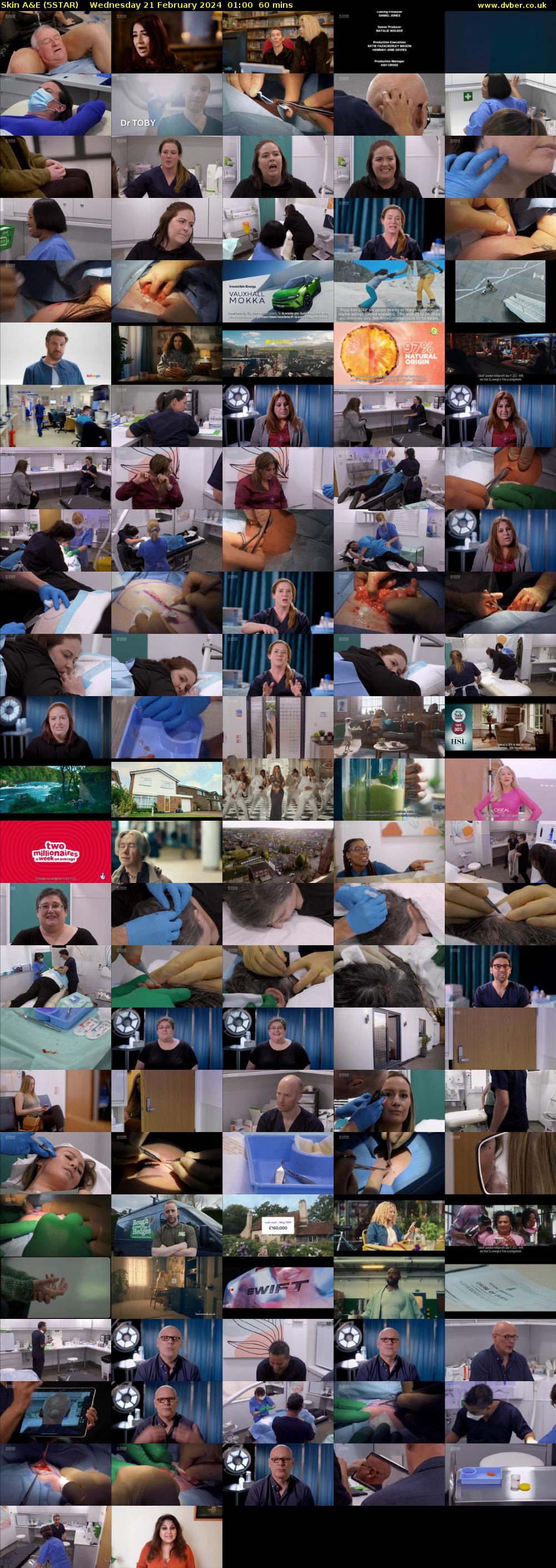 Skin A&E (5STAR) Wednesday 21 February 2024 01:00 - 02:00