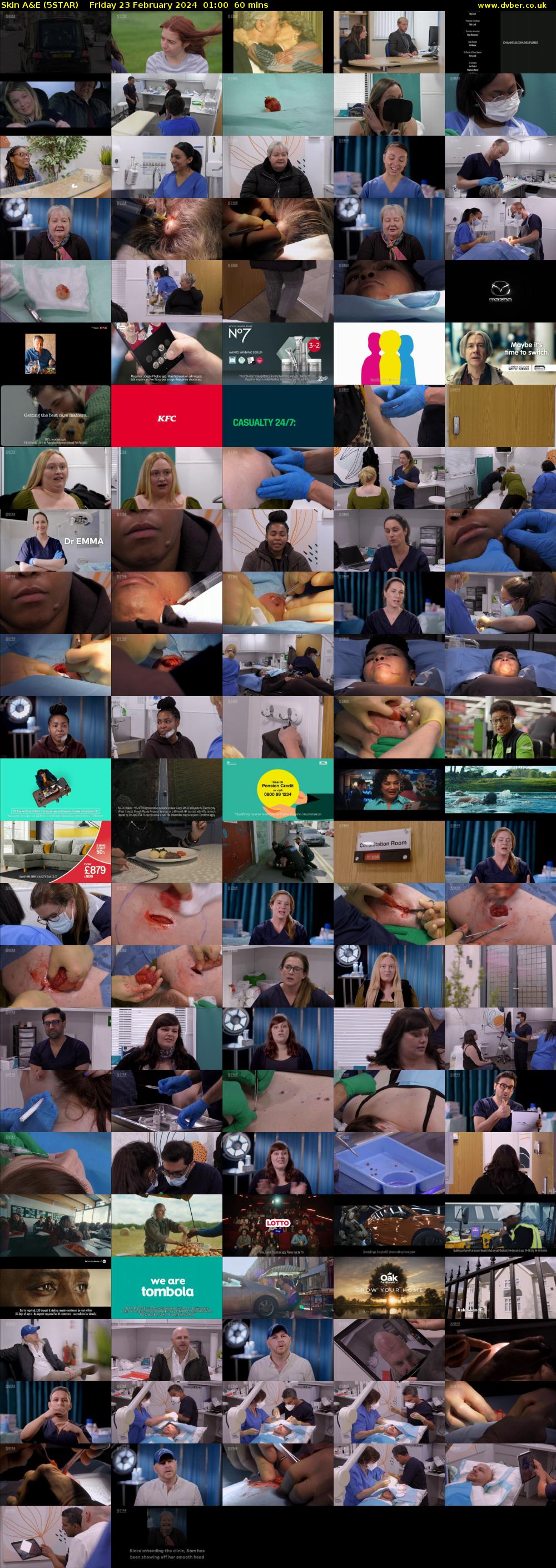 Skin A&E (5STAR) Friday 23 February 2024 01:00 - 02:00