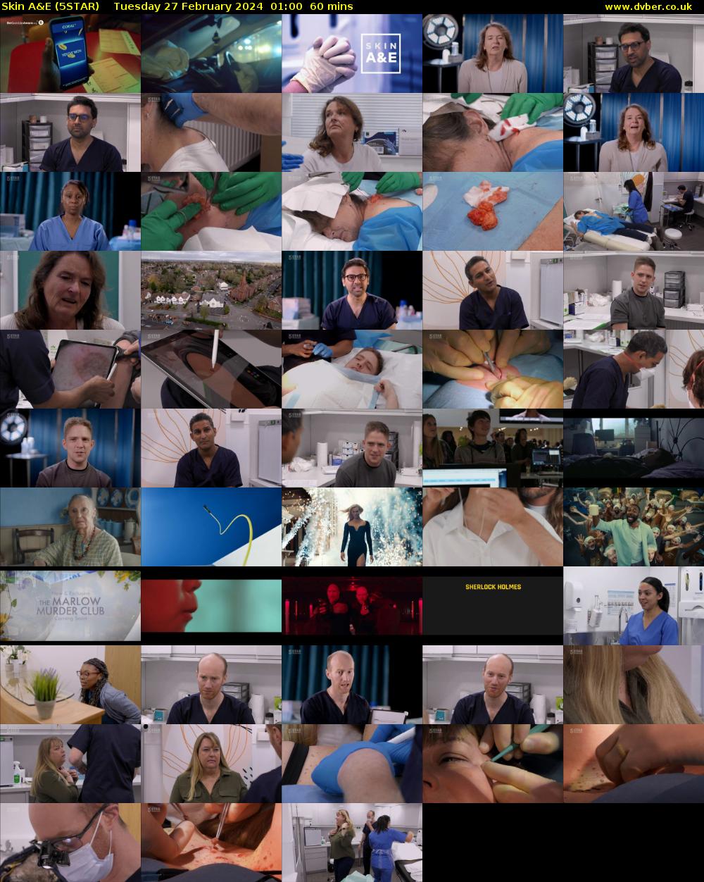 Skin A&E (5STAR) Tuesday 27 February 2024 01:00 - 02:00