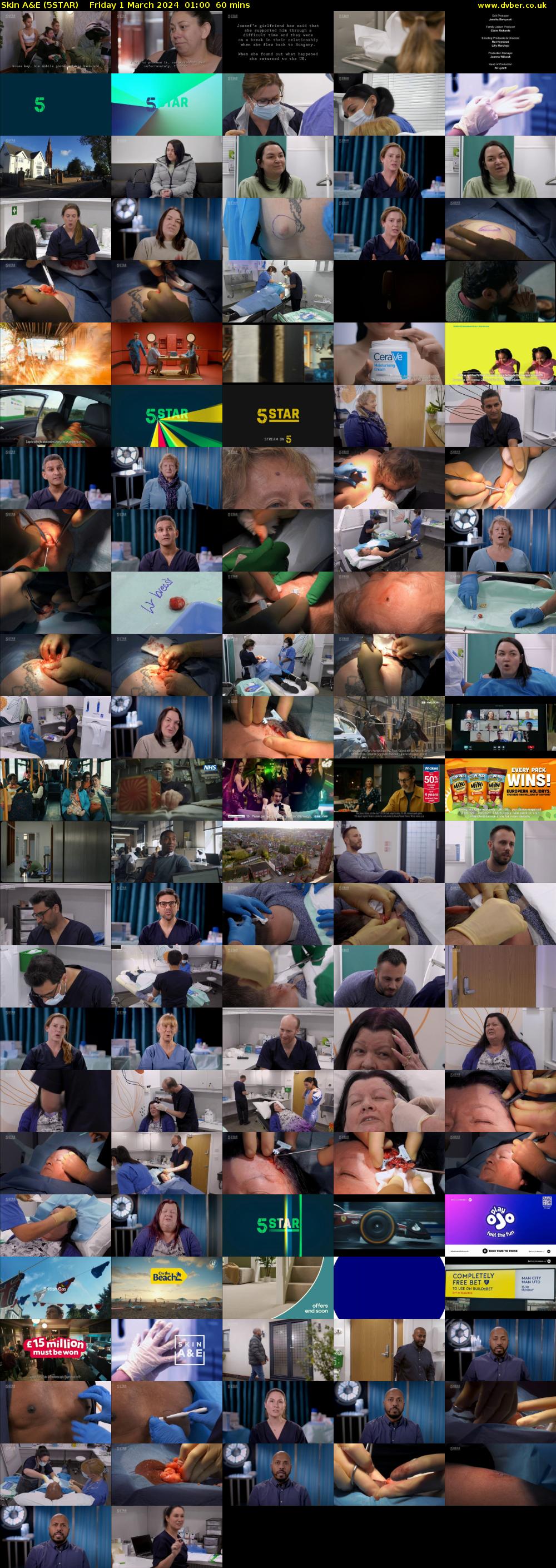 Skin A&E (5STAR) Friday 1 March 2024 01:00 - 02:00