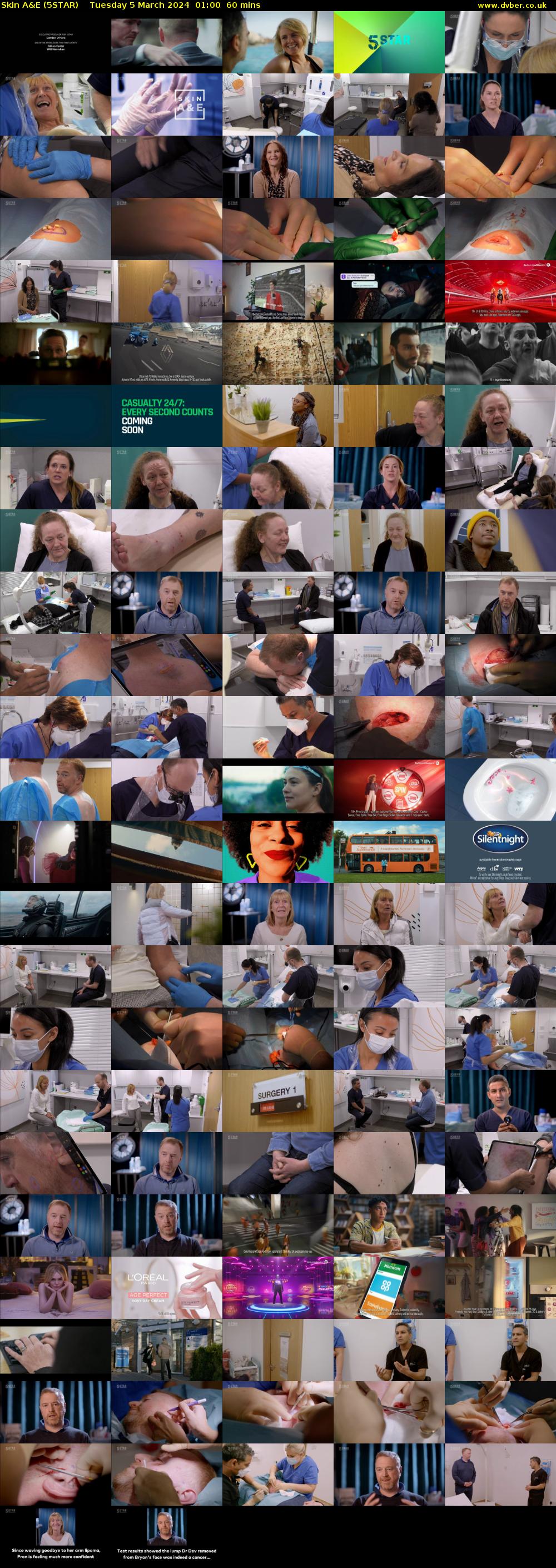 Skin A&E (5STAR) Tuesday 5 March 2024 01:00 - 02:00