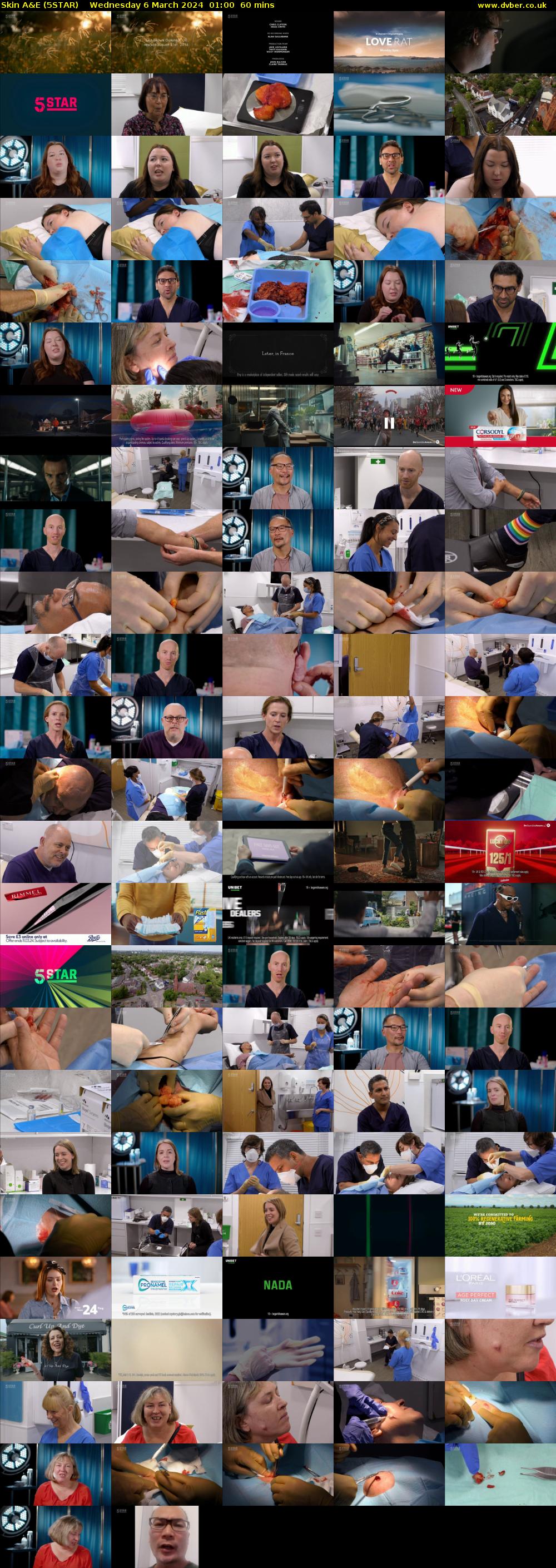 Skin A&E (5STAR) Wednesday 6 March 2024 01:00 - 02:00