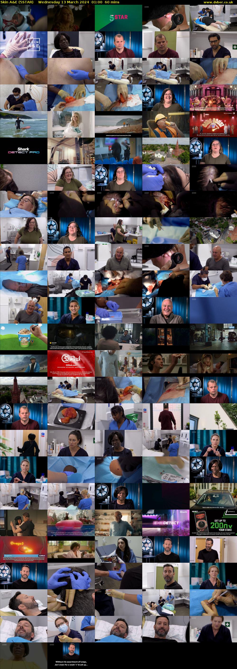 Skin A&E (5STAR) Wednesday 13 March 2024 01:00 - 02:00