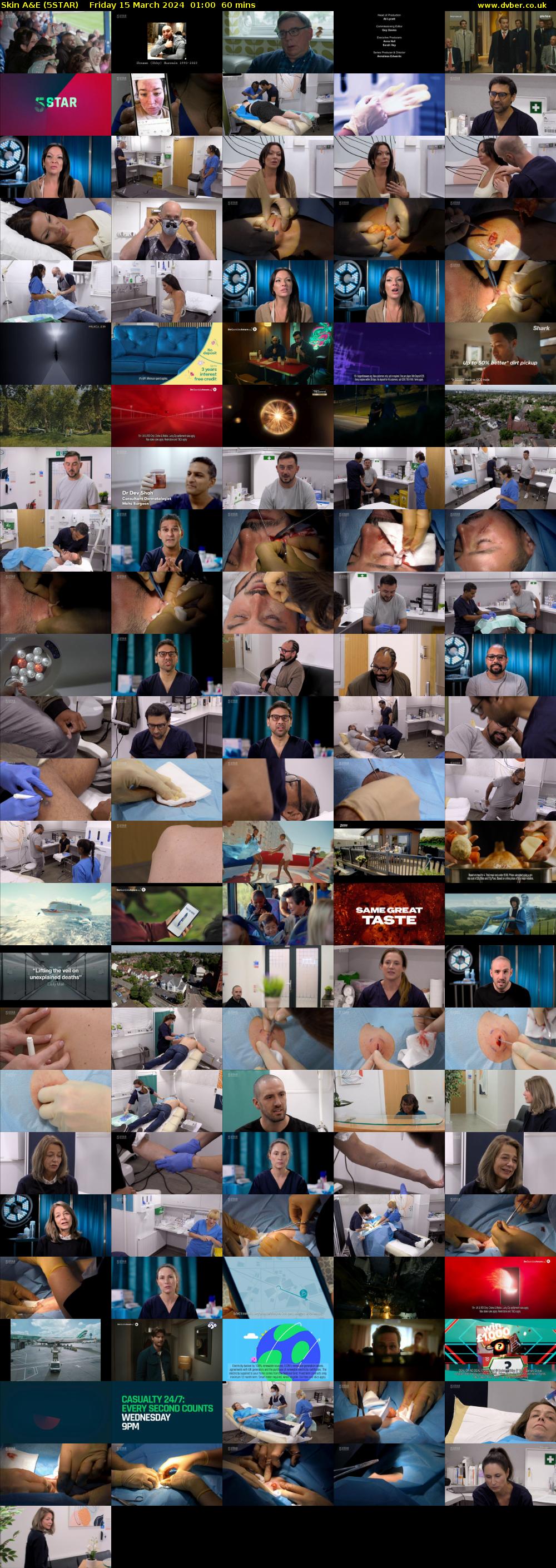 Skin A&E (5STAR) Friday 15 March 2024 01:00 - 02:00