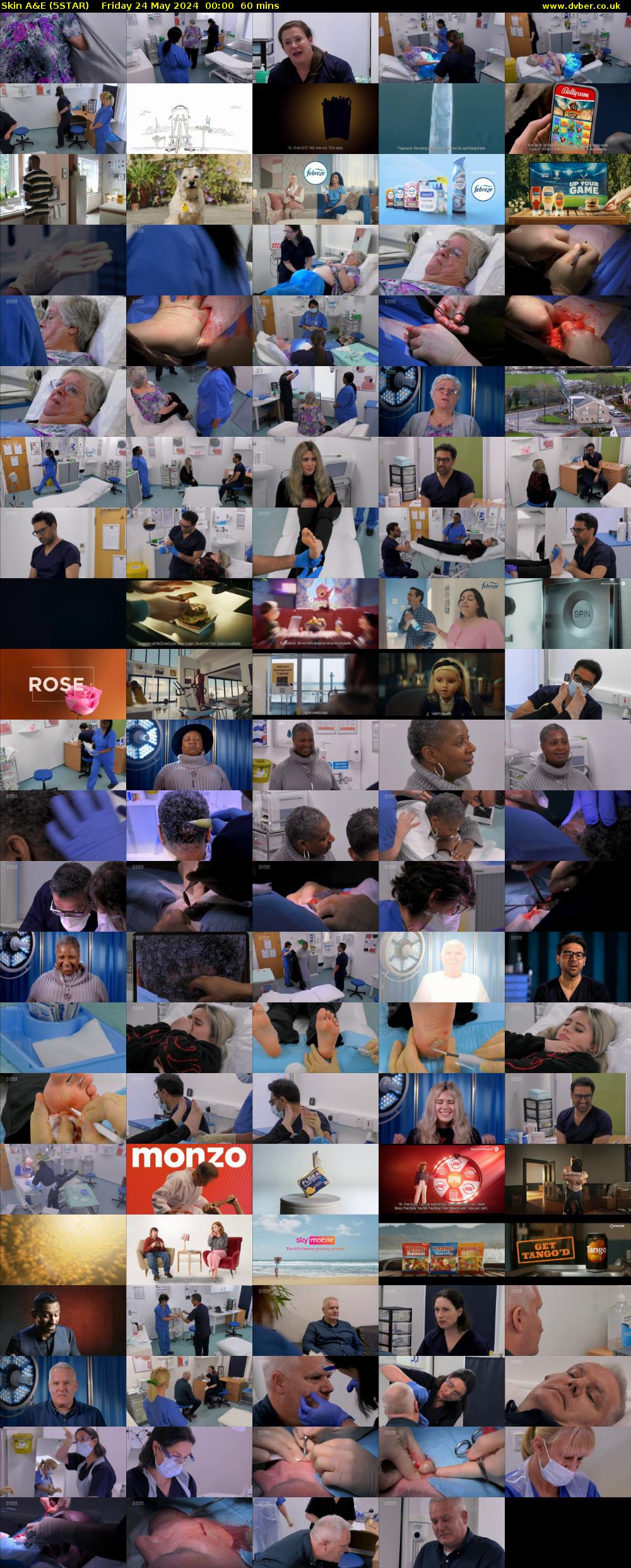 Skin A&E (5STAR) Friday 24 May 2024 00:00 - 01:00