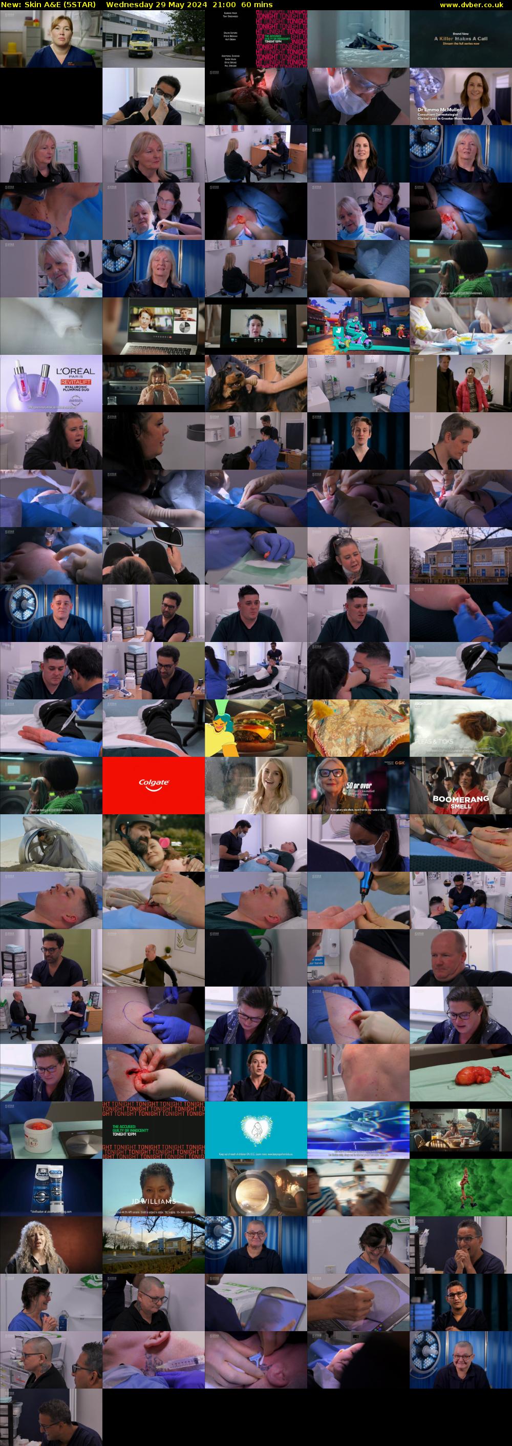 Skin A&E (5STAR) Wednesday 29 May 2024 21:00 - 22:00