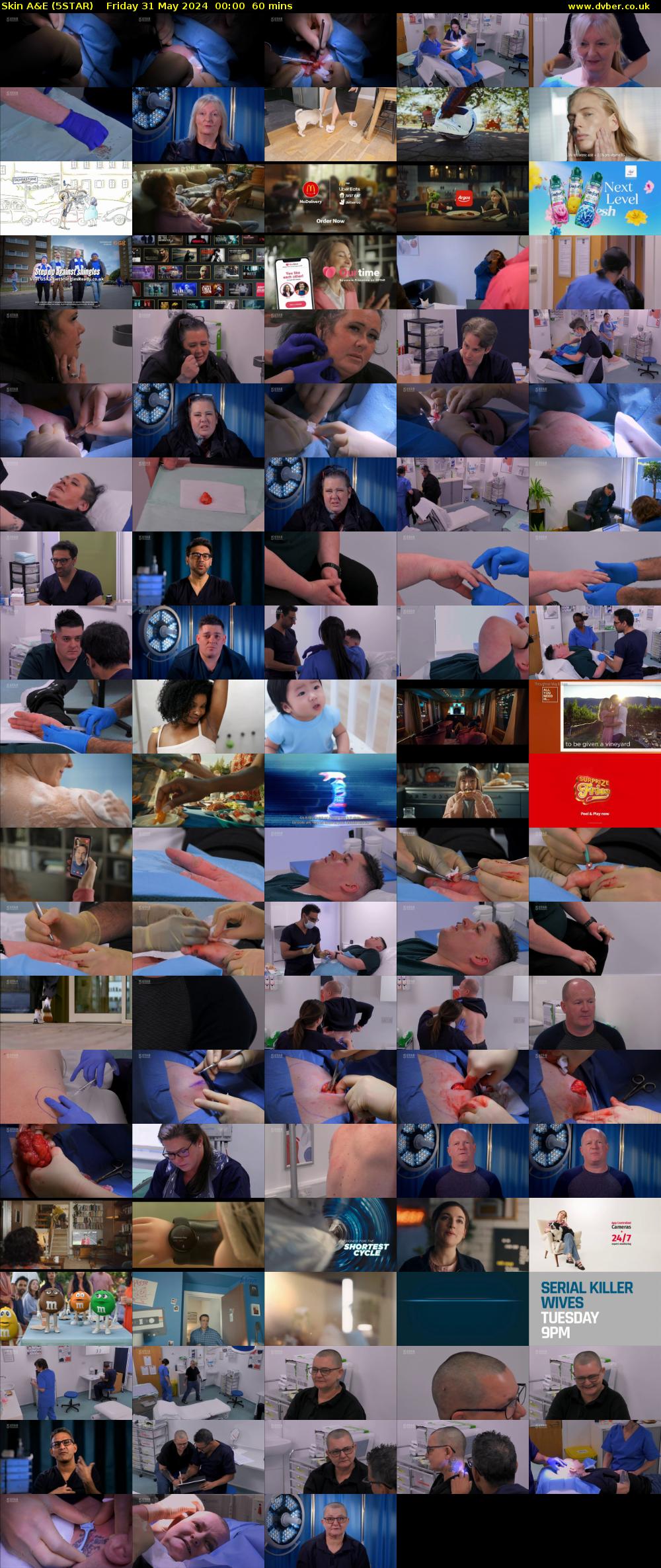 Skin A&E (5STAR) Friday 31 May 2024 00:00 - 01:00