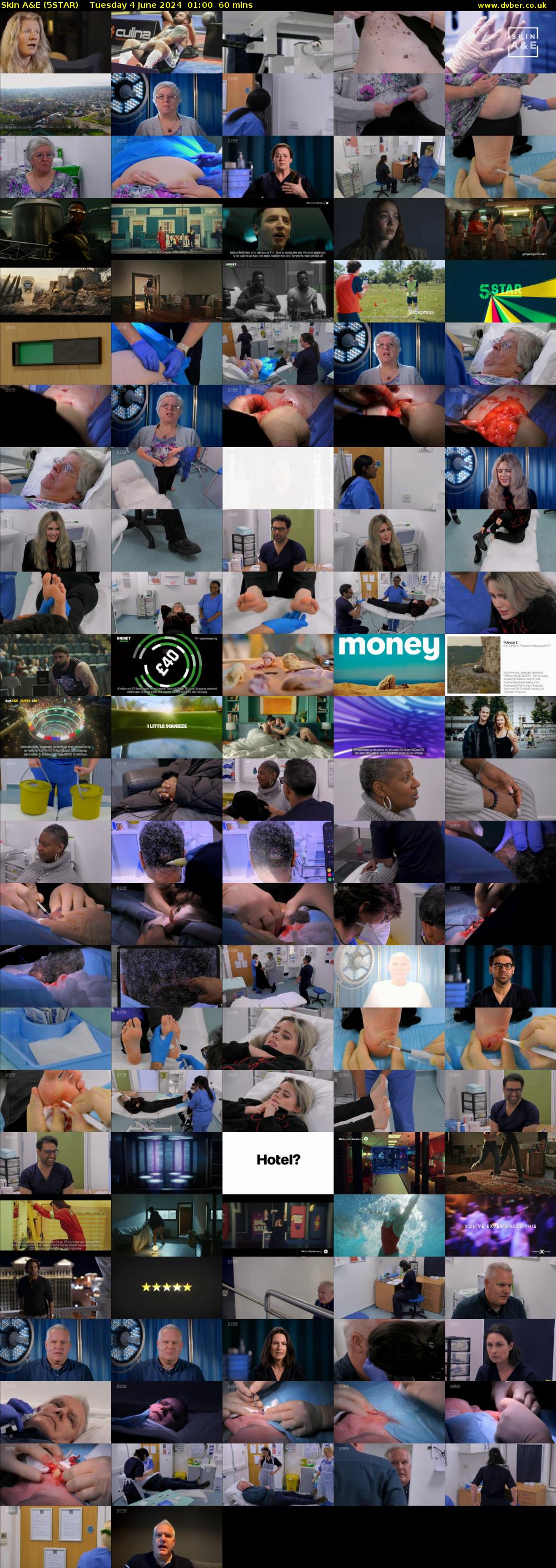 Skin A&E (5STAR) Tuesday 4 June 2024 01:00 - 02:00