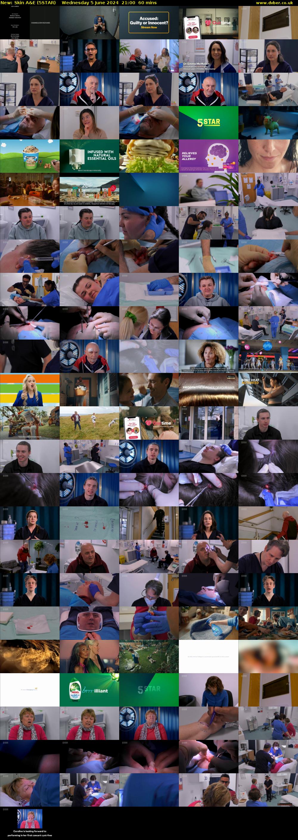 Skin A&E (5STAR) Wednesday 5 June 2024 21:00 - 22:00