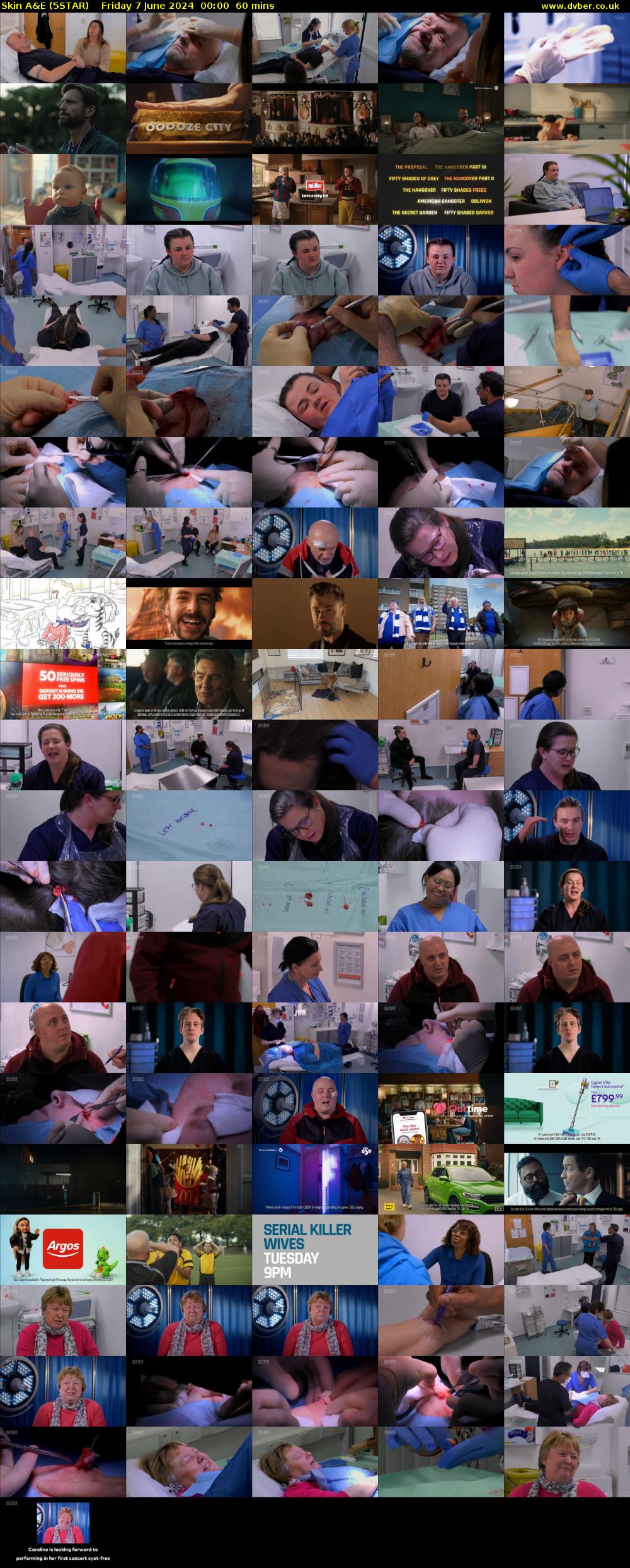 Skin A&E (5STAR) Friday 7 June 2024 00:00 - 01:00